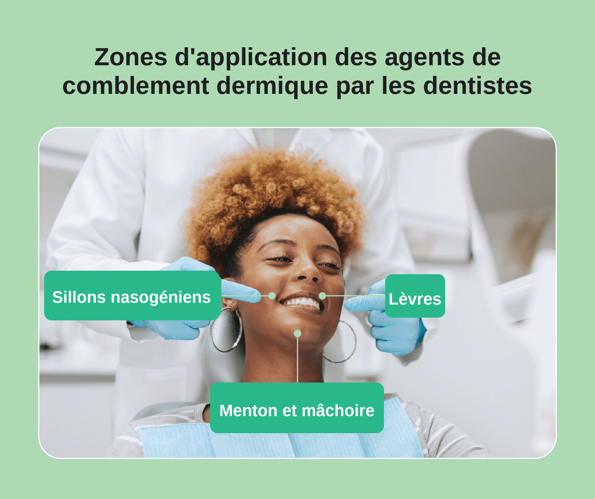Une image montrant les zones où les dentistes sont autorisés à appliquer des agents de comblement dermique.